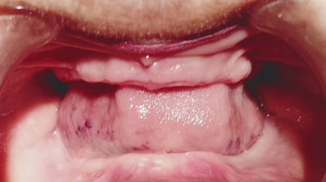 Slider image (5) Smiletec® - Leading Mexicali Dental Clinic